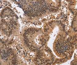 Invitrogen KCNG2 Polyclonal Antibody 100 &mu;L; Unconjugated:Antibodies,
