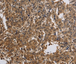 KCNMB4 Polyclonal Antibody:Antibodies, Polyclonal