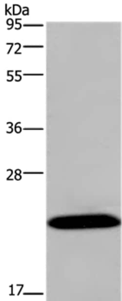 Invitrogen KCNMB4 Polyclonal Antibody 100 &mu;L; Unconjugated:Antibodies,