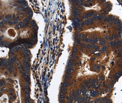 Invitrogen KLHL8 Polyclonal Antibody 100 &mu;L; Unconjugated:Antibodies,