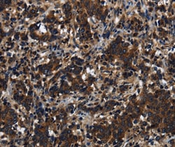Invitrogen KLHL8 Polyclonal Antibody 100 &mu;L; Unconjugated:Antibodies,