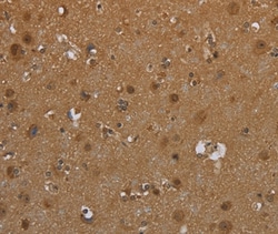 Invitrogen SCGB1D2 Polyclonal Antibody 100 &mu;L; Unconjugated:Antibodies,