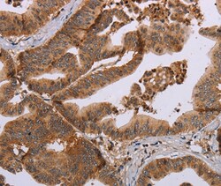 Invitrogen MFAP5 Polyclonal Antibody 100 &mu;L; Unconjugated:Antibodies,