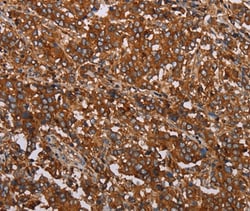 Invitrogen MFAP5 Polyclonal Antibody 100 &mu;L; Unconjugated:Antibodies,