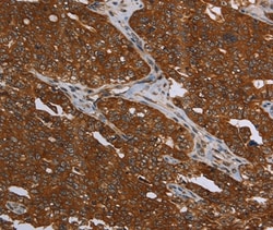 Invitrogen MCHR1 Polyclonal Antibody 100 &mu;L; Unconjugated:Antibodies,