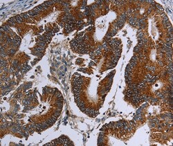 Invitrogen MDFIC Polyclonal Antibody 100 &mu;L; Unconjugated:Antibodies,