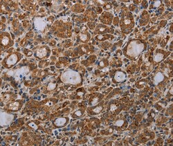 Invitrogen MDFIC Polyclonal Antibody 100 &mu;L; Unconjugated:Antibodies,