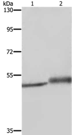 Invitrogen Mig-6 Polyclonal Antibody 100 &mu;L; Unconjugated:Antibodies,