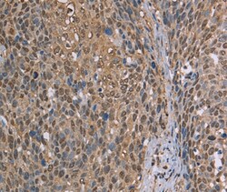 Invitrogen CAB39 Polyclonal Antibody 100 &mu;L; Unconjugated:Antibodies,