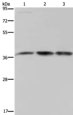 Invitrogen CAB39 Polyclonal Antibody 100 &mu;L; Unconjugated:Antibodies,