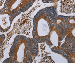 Invitrogen MT-ND6 Polyclonal Antibody 100 &mu;L; Unconjugated:Antibodies,