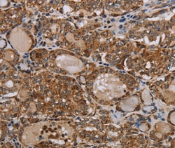 Invitrogen MT-ND6 Polyclonal Antibody 100 &mu;L; Unconjugated:Antibodies,