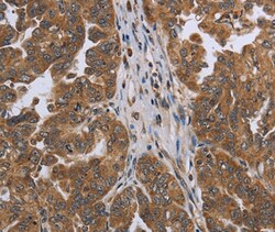 Invitrogen NDUFAF4 Polyclonal Antibody 100 &mu;L; Unconjugated:Antibodies,