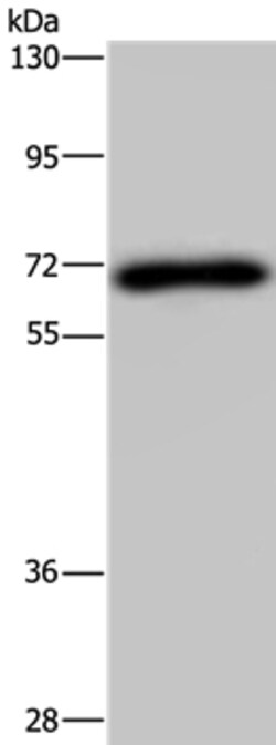 Invitrogen NMT1 Polyclonal Antibody 100 &mu;L | Buy Online | Invitrogen&trade; | Fisher Scientific