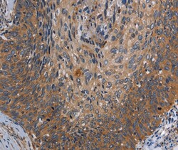 Invitrogen PARP10 Polyclonal Antibody 100 &mu;L | Buy Online | Invitrogen&trade; | Fisher Scientific