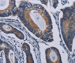 Invitrogen PCDHAC2 Polyclonal Antibody 100 &mu;L; Unconjugated:Antibodies,