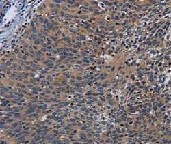 Invitrogen PCDHB15 Polyclonal Antibody 100 &mu;L; Unconjugated:Antibodies,