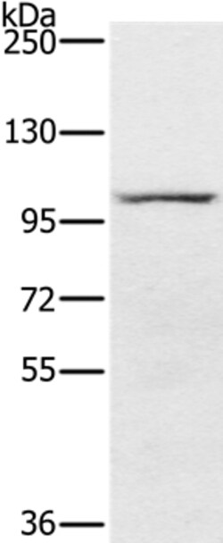 Invitrogen PDE5 Polyclonal Antibody 100 &mu;L; Unconjugated:Antibodies,