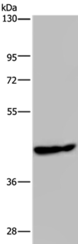 Invitrogen PHKG1 Polyclonal Antibody 100 &mu;L; Unconjugated:Antibodies,