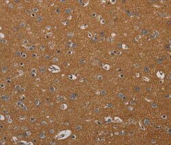 Invitrogen PIK3CD Polyclonal Antibody 100 &mu;L; Unconjugated:Antibodies,