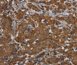 Invitrogen PIK3CD Polyclonal Antibody 100 &mu;L; Unconjugated:Antibodies,