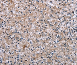 Invitrogen PLCL1 Polyclonal Antibody 100 &mu;L; Unconjugated:Antibodies,