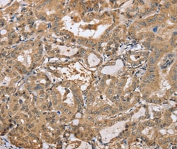 Invitrogen PPP2R3A Polyclonal Antibody 100 &mu;L; Unconjugated:Antibodies,