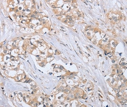 Invitrogen PTPN4 Polyclonal Antibody 100 &mu;L; Unconjugated:Antibodies,