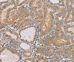 Invitrogen PTPN4 Polyclonal Antibody 100 &mu;L; Unconjugated:Antibodies,