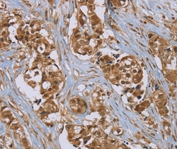 PUS10 Polyclonal Antibody:Antibodies, Polyclonal
