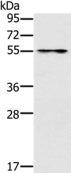 Invitrogen PUS10 Polyclonal Antibody 100 &mu;L; Unconjugated:Antibodies,