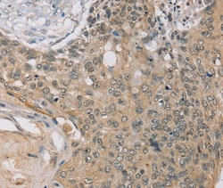 Invitrogen RASA2 Polyclonal Antibody 100 &mu;L; Unconjugated:Antibodies,