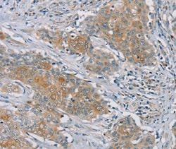 Invitrogen RASA2 Polyclonal Antibody 100 &mu;L; Unconjugated:Antibodies,