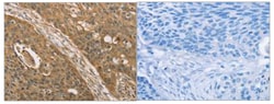 Invitrogen KDM5A Polyclonal Antibody 100 &mu;L; Unconjugated:Antibodies,