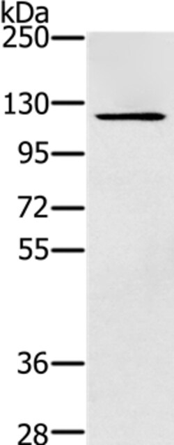 Invitrogen ZMIZ1 Polyclonal Antibody 100 &mu;L; Unconjugated:Antikroppar