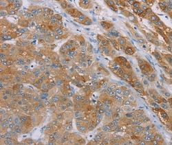 Invitrogen SAMD4A Polyclonal Antibody 100 &mu;L; Unconjugated:Antibodies,
