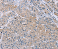 Invitrogen SAMD4B Polyclonal Antibody 100 &mu;L; Unconjugated:Antibodies,