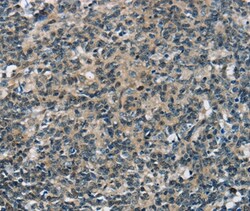 Invitrogen SEPN1 Polyclonal Antibody 100 &mu;L; Unconjugated:Antibodies,