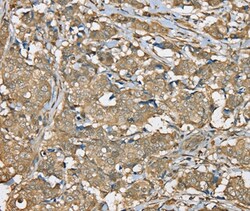 Invitrogen SERPINA11 Polyclonal Antibody 100 &mu;L | Buy Online | Invitrogen&trade; | Fisher Scientific