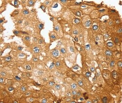 Invitrogen SESN2 Polyclonal Antibody 100 &mu;L; Unconjugated:Antibodies,