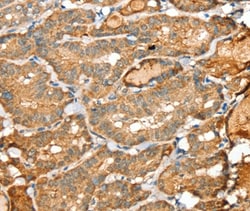 Invitrogen SIGLEC14 Polyclonal Antibody 100 &mu;L; Unconjugated:Antibodies,