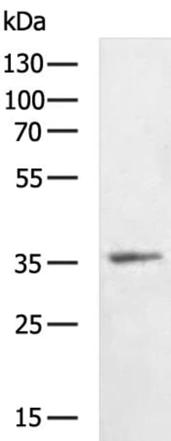 Invitrogen SIGLEC15 Polyclonal Antibody 100 &mu;L; Unconjugated:Antibodies,