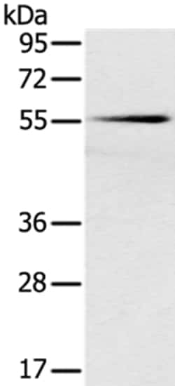 Invitrogen SLC16A10 Polyclonal Antibody 100 &mu;L; Unconjugated:Antibodies,