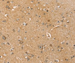 Invitrogen SLC41A3 Polyclonal Antibody 100 &mu;L; Unconjugated:Antibodies,