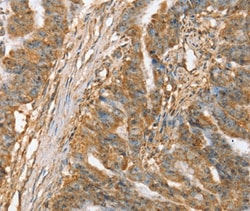 Invitrogen SLC41A3 Polyclonal Antibody 100 &mu;L; Unconjugated:Antibodies,