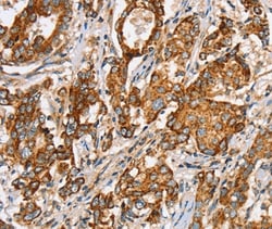 Invitrogen SLC5A11 Polyclonal Antibody 100 &mu;L; Unconjugated:Antibodies,