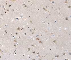 Invitrogen SLC6A7 Polyclonal Antibody 100 &mu;L; Unconjugated:Antibodies,