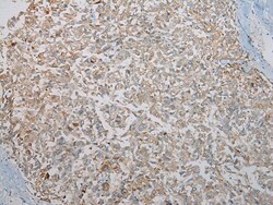 Invitrogen KCNH6 Polyclonal Antibody 100 &mu;L; Unconjugated:Antibodies,