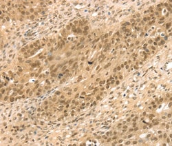 STAG2 Polyclonal Antibody:Antibodies, Polyclonal