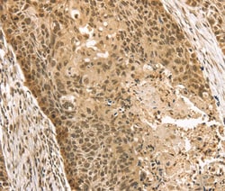 STAG2 Polyclonal Antibody:Antibodies, Polyclonal